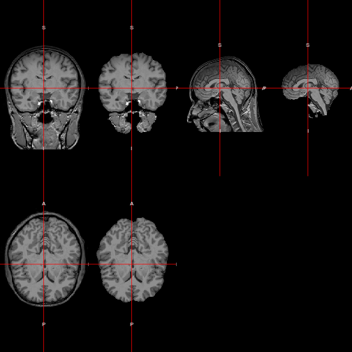 plot of chunk double_ortho