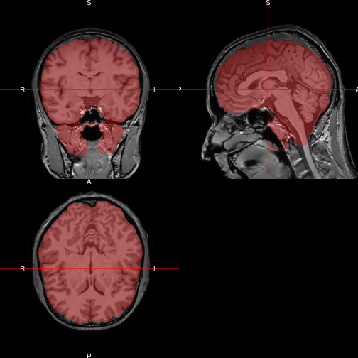 plot of chunk ortho2