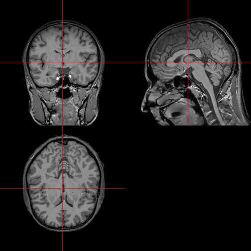 plot of chunk orthographic