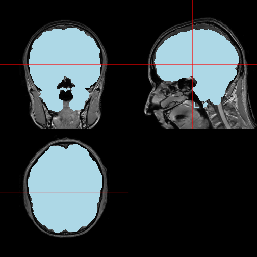 plot of chunk orthographic_mask